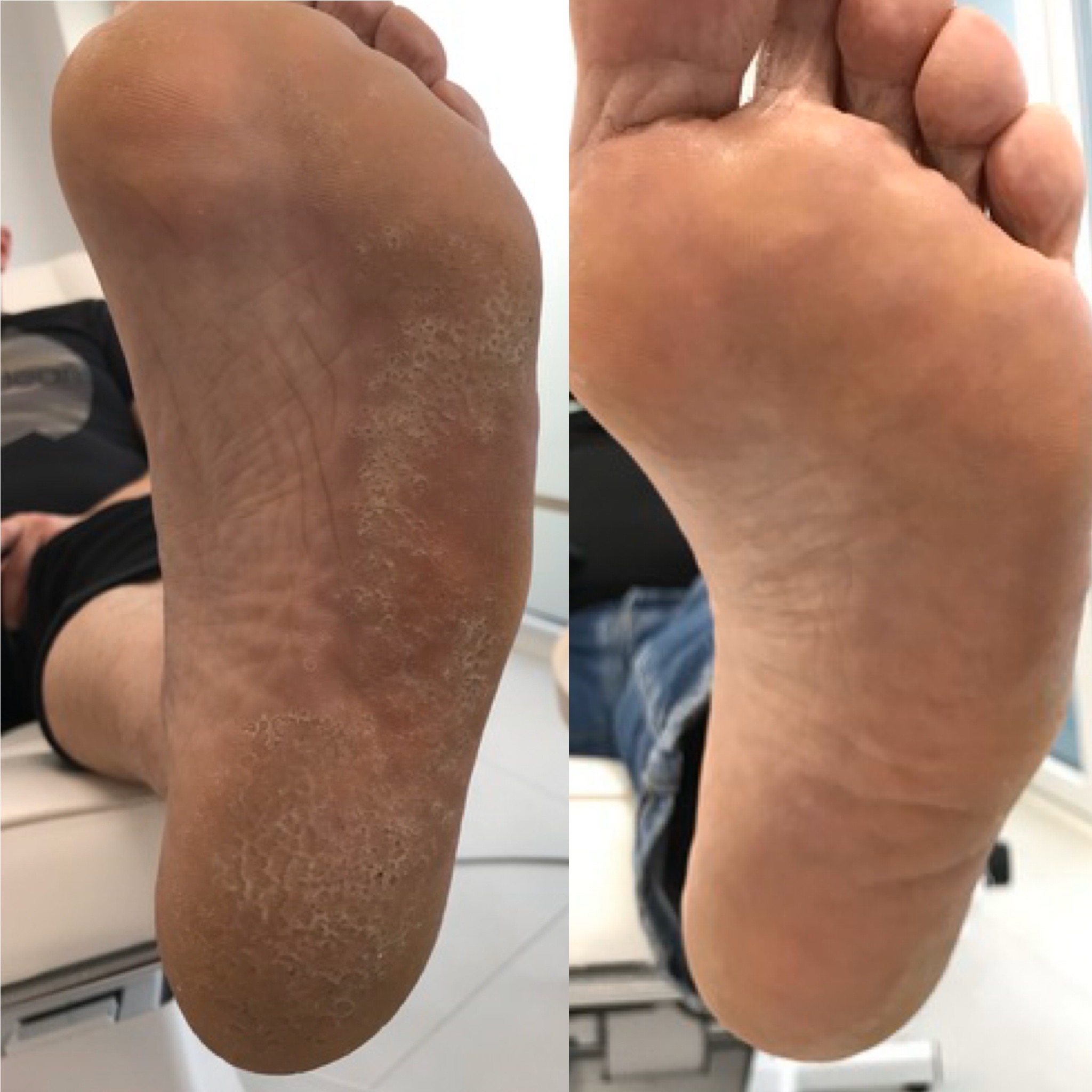 Pedicure podologiczny